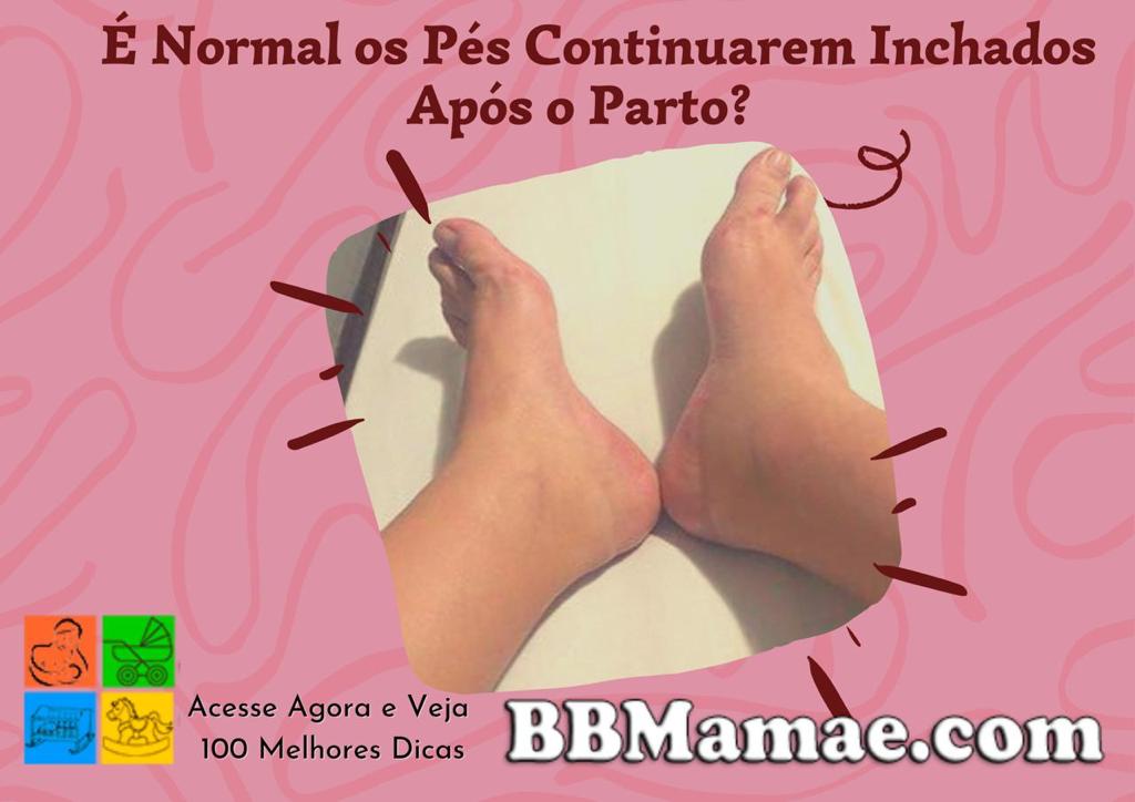 É Normal os Pés Continuarem Inchados Após o Parto?