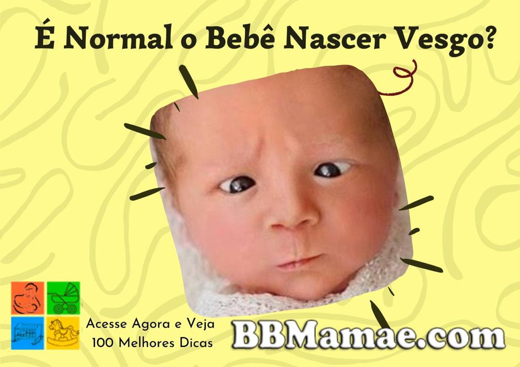 É Normal o Bebê Nascer Vesgo?
