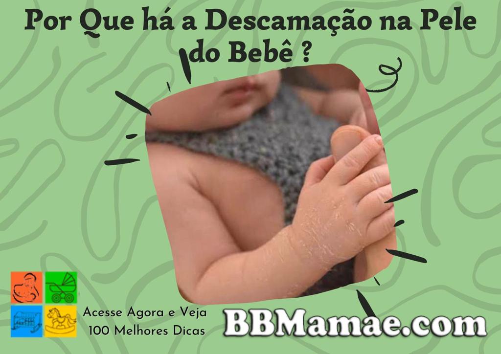 Por que Há a Descamação na Pele do Bebê ?